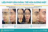 Top 3  cơ sở  trẻ hóa căng da mặt uy tín  tại  TPHCM
