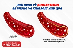 Hiểu đúng về cholesterol để phòng và kiểm soát hiệu quả