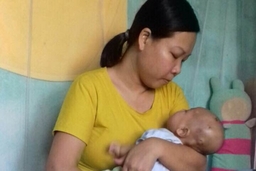 Người mẹ trẻ cạn nước mắt vì con mắc bệnh hiểm nghèo