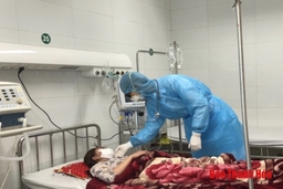 Chủ động các biện pháp phòng ngừa bệnh viêm đường hô hấp cấp do chủng mới của virus Corona