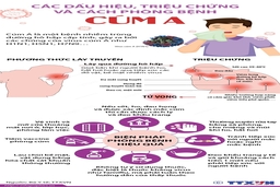 [Infographics] Các dấu hiệu, triệu chứng và cách phòng bệnh cúm A