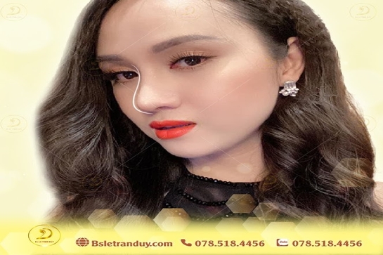 Nâng mũi tự nhiên đẹp không khó ở bác sỹ giỏi