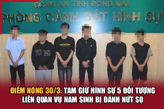 Điểm nóng 30/3: Tạm giữ hình sự 5 đối tượng liên quan vụ nam sinh bị đánh nứt sọ