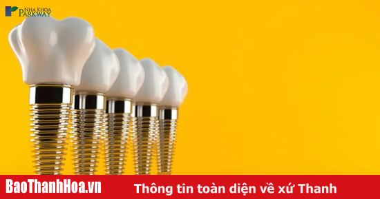 Trồng răng implant parkway có hiệu quả như thế nào?